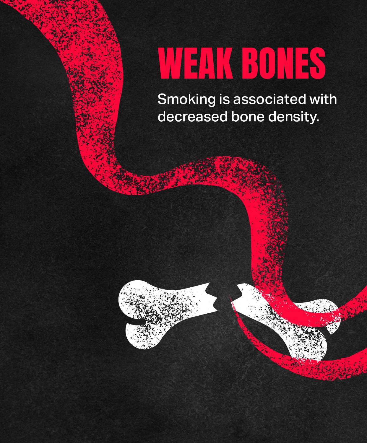 WEAK BONES: Smoking is associated with decreased bone density.