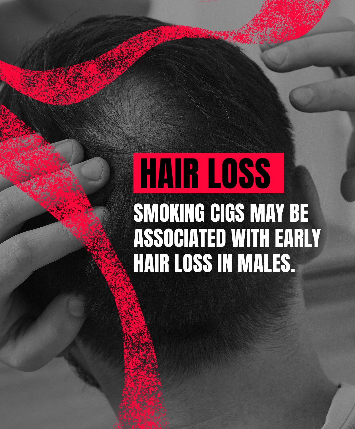 HAIR LOSS: Smoking cigarettes may be associated with early hair loss in males.